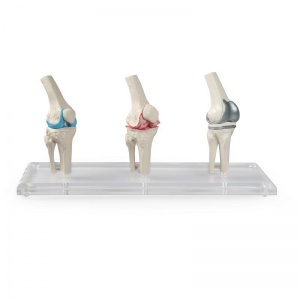 Erler-Zimmer Knee Joint Models (Set of 3)